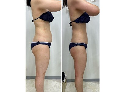 ステラ(Stella)｜ホットペッパービューティー