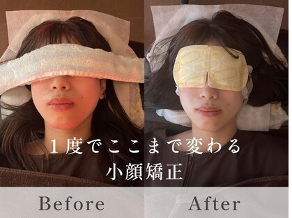 雲上の休息の写真