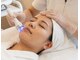 小顔・脂肪コントロール専門 salon de nurse U.sona～松本店～の写真/【人気NO.1】医療級マシン×脂肪コントロールで究極の引き締め・顔造形♪パックやマッサージなど込み◎