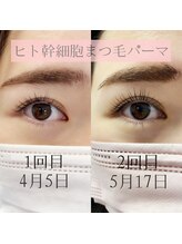 アイビューティー(AI beauty)/ヒト幹細胞まつげパーマ