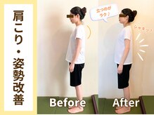 ゲンキ鍼灸整骨院(Genki鍼灸整骨院)/猫背改善