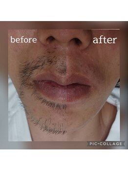 ルテラ(Lutella)/ヒゲワックス