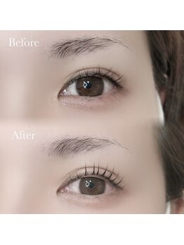 ハリス(HARIS)/ビフォーアフター