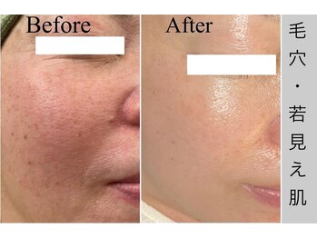 ブラックボックス(BLACK BOX)/東海村M様