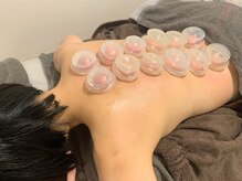 サクラプラス(SAKURA Plus)/カッピング