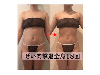 ハナチュチュ 矢場町店(Hanachuchu)/