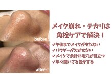 毛穴美の雰囲気（毛穴悩みは人それぞれ！）