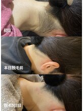 エリクサー 太田店(Elixir)/えりあしbefore/after