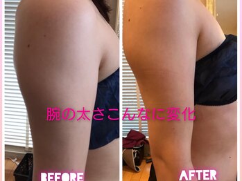 サロンハナ(Salon HANA)/背中&二の腕スリムコース