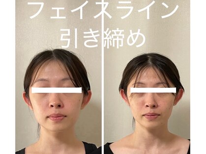ミラ 長崎駅前店(MIRA)の写真