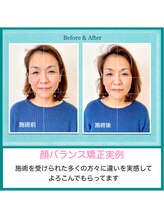 誠心流手技整体療法/顔バランス矯正Before&After