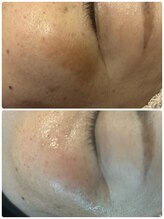 エルール トータルビューティ(Aileure total beauty)/ララピール