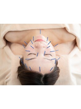 鍼灸施術を受けたい