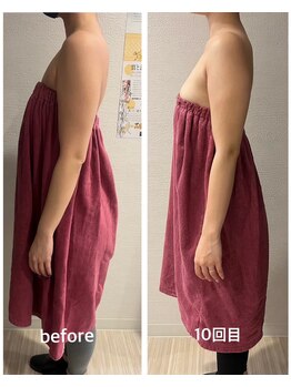 ロココ 豊田店(Rococo)/ビフォーアフター