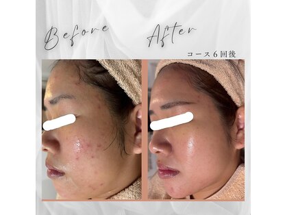 コノア ブランシェ(CONOA BLANCHE)の写真