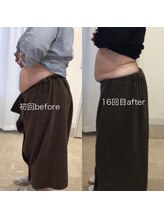 ジョワイユ(Joyeux)/腸の位置でお腹は変わる