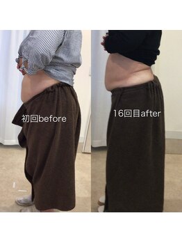 ジョワイユ(Joyeux)/腸の位置でお腹は変わる