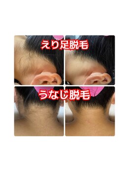 レイラニア(Leilani.Am)/えりあし・うなじでスッキリ