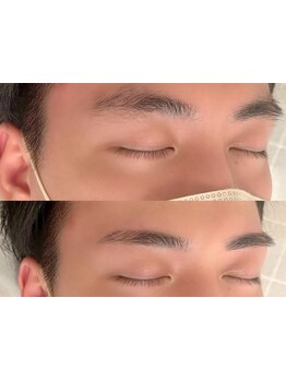 メンズフェイシャル