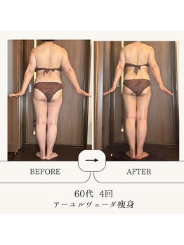 アーユルヴェーダアンドアロマエステ アユス(AYUS)/【60代】痩身初回⇒4回目