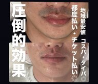 ルシアル(LUCIALL)