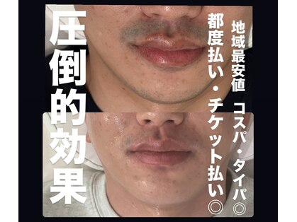 ルシアル(LUCIALL)の写真