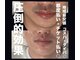 ルシアル(LUCIALL)の写真
