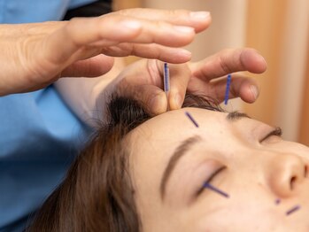 安心堂幕張接骨院 鍼灸院