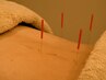 2回目以降[ どんなお悩みでも ] 鍼灸施術（カウンセリング込み）40分