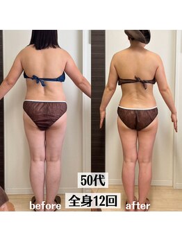 グラチア(Gratiae)/