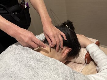 整骨院タビ(tabi)の写真/【市役所前駅11番出口北へ100m】肩こり・腰痛などの不調はもちろん美容鍼でフェイスラインをキレイに♪