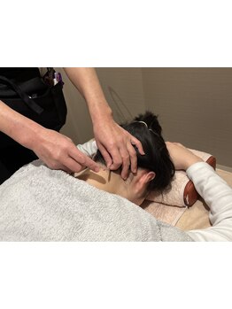 鍼灸施術を受けたい