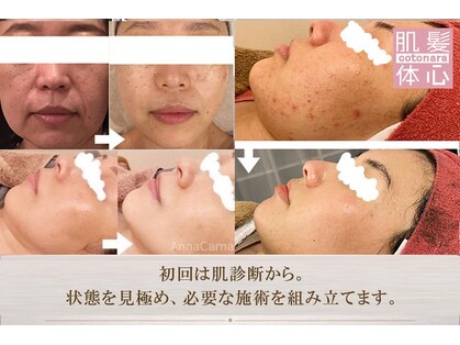 アンナカルナ(AnnaCarna)の写真