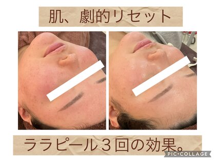 リリウム(Lilium)の写真