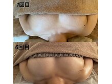 美人バスト 岡崎店/【バストアップ★育乳】症例