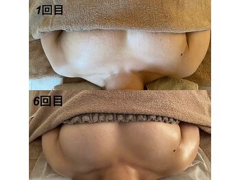 美人バスト 岡崎店/【バストアップ★育乳】症例