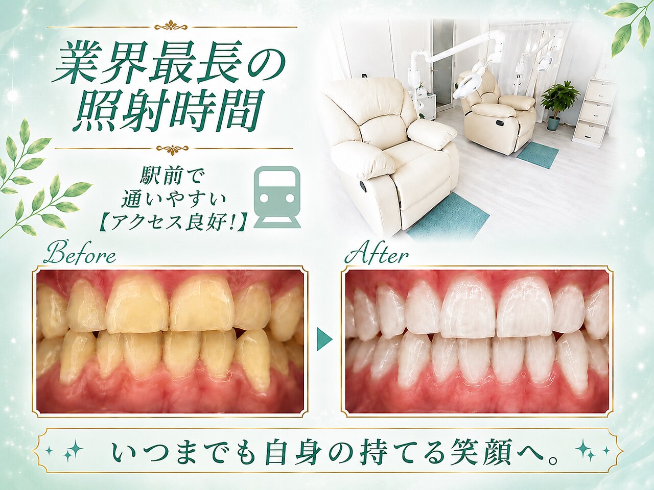 ホワイトニングショップ 湘 南辻堂店｜ホットペッパービューティー