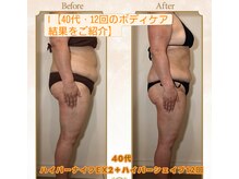 ドクタースタイル(Dr.style)/全身ボディメイク12回の結果を