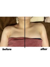 エイシスグロウ(asis glow.)/効果写真