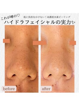 ミーカラー(mecalla.)/