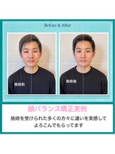 誠心流手技整体療法/顔バランス矯正Before&After