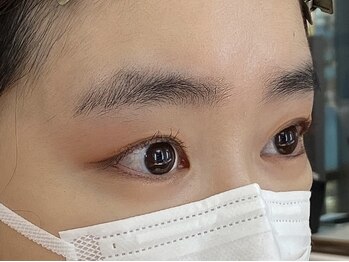 ビューティーガーデン イース/BEFORE