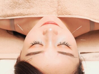 神戸はりのわ鍼灸院の写真/緊張した筋肉、SMAS筋膜へダイレクトに鍼をあてることで血流UP◎未来の若々しいお顔へ導く結果重視の施術。