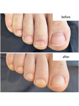 ケアプラス(care plus)/フットネイルケア