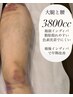 【術前/術後】ダウンタイム・顔orボディ/凹凸改善/拘縮が軽減インディバ1時間