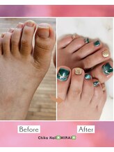 チカネイルミライ(Chika Nail ☆MIRAI★)/フィルイン/マグネット