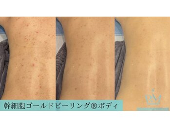 リメイク 広尾(REMAKE)/