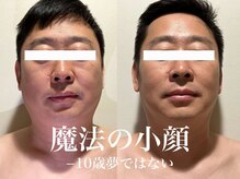 健康美 東洋医学療法院 鴻巣店/魔法のかっさマッサージ　　