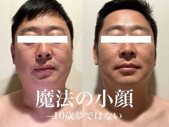 健康美 東洋医学療法院 鴻巣店/魔法のかっさマッサージ