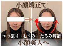 メディカモン(medikamon)の雰囲気(小顔矯正で、スッキリ小顔へ★むくみ解消&リフトアップ)